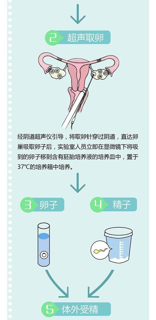 做试管代怀的步骤-试管代怀:从准备到成功的关键步骤